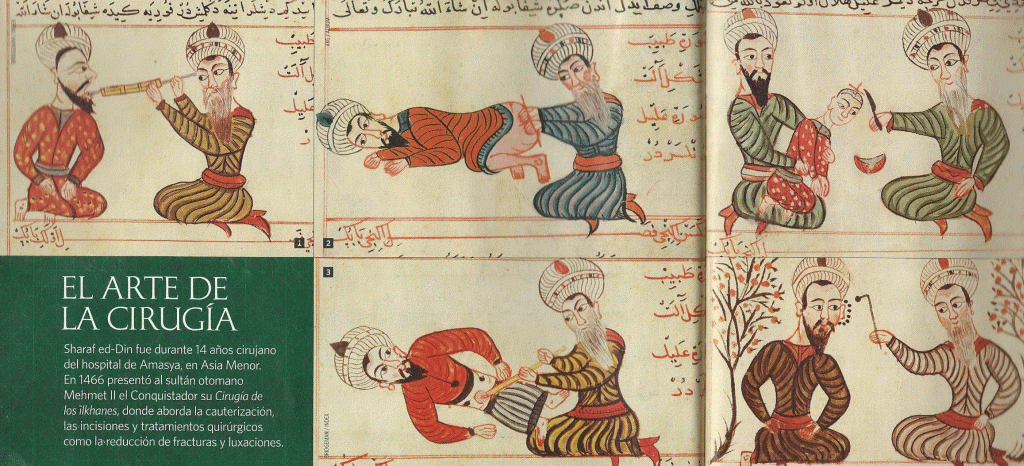Miniatura XV Shaf ed-Din Cirugia de los ilkhanes - cauteriz